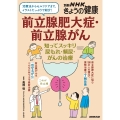 前立腺肥大症・前立腺がん 知ってスッキリ 尿もれ・頻尿・がんの治療