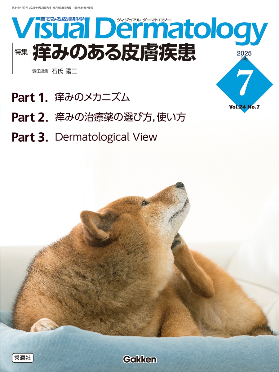 Visual D. 2025年7月号 Vol.24 No.7 痒みのある皮膚疾患