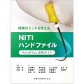 保険のエンドを変えるNiTiハンドファイル HandFlex活用ガイド