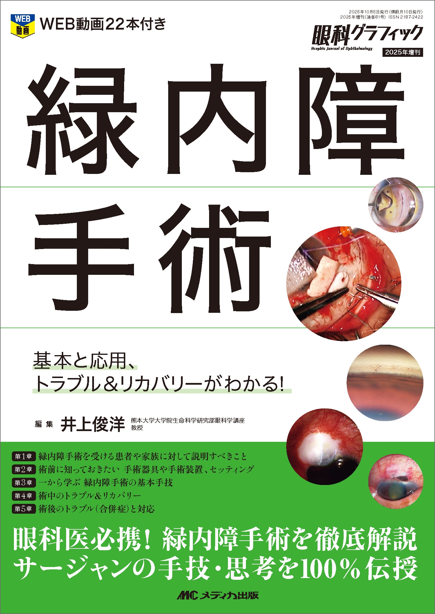 井上俊洋/緑内障手術 基本と応用、トラブル&リカバリーがわかる![9784840487535]