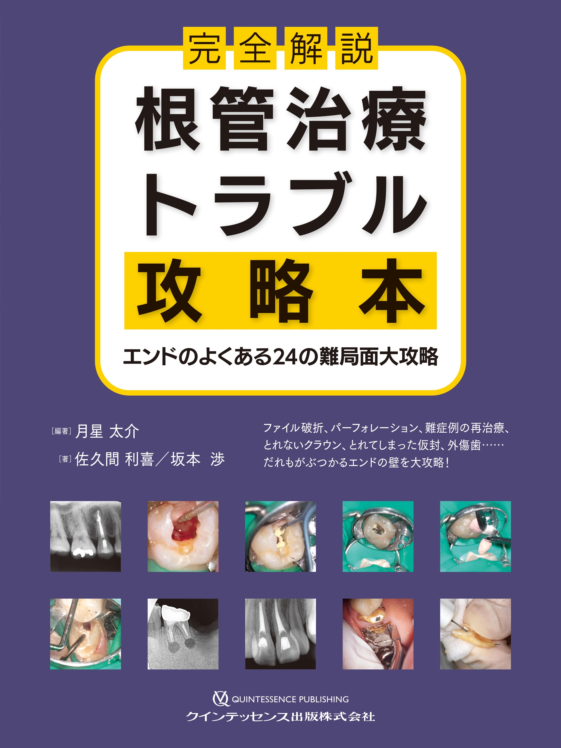 完全解説 根管治療トラブル攻略本 : エンドのよくある24の難局面大攻略 完全解説 根管治療トラブル攻略本 エンドのよくある24の難局面大