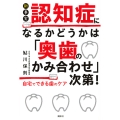 新事実 認知症になるかどうかは「奥歯のかみ合わせ」次第! 自宅でできる歯のケア