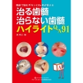 治る歯髄 治らない歯髄 ハイライトQ&A91 臨床で悩むギモンにDr.泉が答える