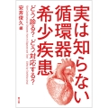 実は知らない循環器希少疾患 どう診る?どう対応する?