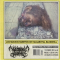 Los muchos muertos de VULGAROYAL BLOODHILL