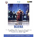 ベッリーニ: 歌劇『ノルマ』全曲