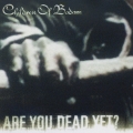 アー・ユー・デッド・イエット?＜初回生産限定盤＞