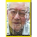 核の傷:肥田舜太郎医師と内部被爆
