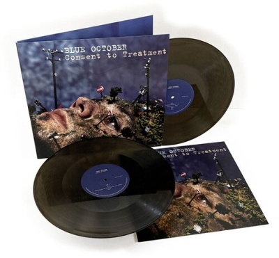 Consent To Treatment