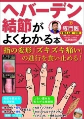 高橋嗣明 ヘバーデン結節がよくわかる本 指の変形 ズキズキ痛い の進行を食い止める