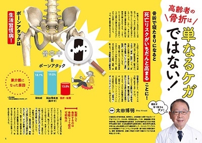骨を強くして、骨折・骨粗しょう症・寝たきりを防ぐ! TJ MOOK 骨を強くして、骨折・骨粗しょう症・寝たきりを防ぐ! TJ MOOK