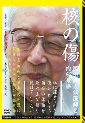 核の傷:肥田舜太郎医師と内部被爆