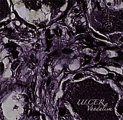 TOWER RECORDS ONLINE㤨Ulcer/Vandalism[HCK-044]פβǤʤ1,650ߤˤʤޤ