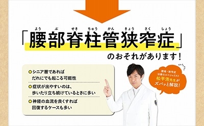 10秒から始める!脊柱管狭窄症これだけ体操 増補改訂版 TJ MOOK 10秒から始める!脊柱管狭窄症これだけ体操 増補改訂版 TJ MOOK