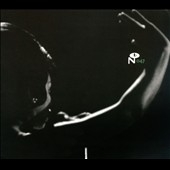 Eccentric Soul: The Forte Label