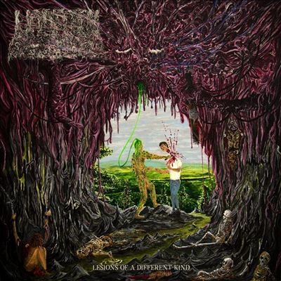 TOWER RECORDS ONLINE㤨Undeath/Lesions Of A Different Kindס[105534]פβǤʤ5,290ߤˤʤޤ