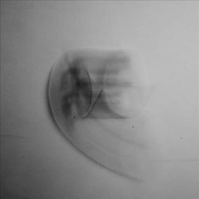 Acoustic Collection＜限定盤＞