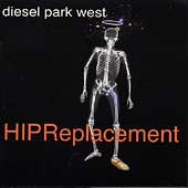 HIP Replacement